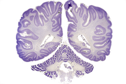 Human brain coronal slice cell stain