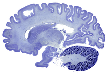 Human brain sagittal slice cell stain