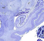 Human hippocampus slice cell stain